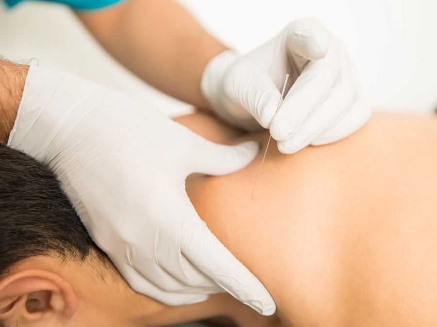 treatments.dryneedling